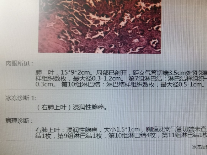 苏州九龙医院多科联手开展微创手术，助市民摆脱早期肺癌困扰