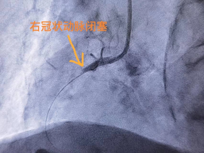 94岁高龄患者突发胸痛，苏州市中医医院多科协作成功救治