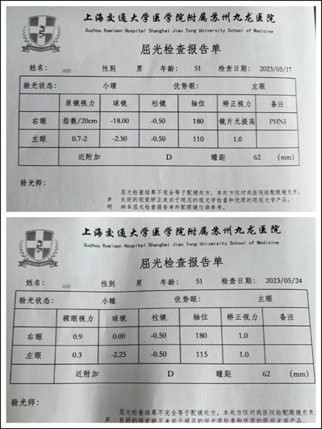 才50岁就得白内障？苏州九龙医院：出现这个症状别大意