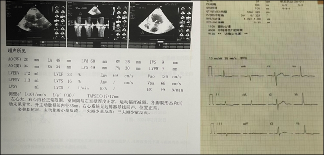 心脏治疗再突破！苏州九龙医院顺利完成一台高难度心脏手术