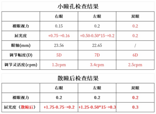 苏州一女孩突然视力下降！医生提醒，出现这种情况一定要重视