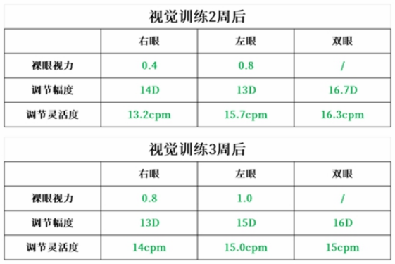 苏州一女孩突然视力下降！医生提醒，出现这种情况一定要重视