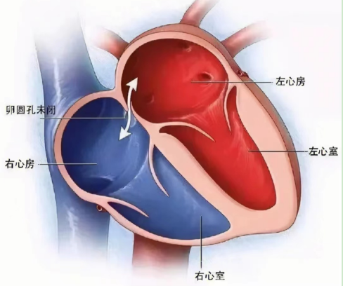 “偏头疼”到怀疑人生？医生：未必是头的问题，千万要引起重视
